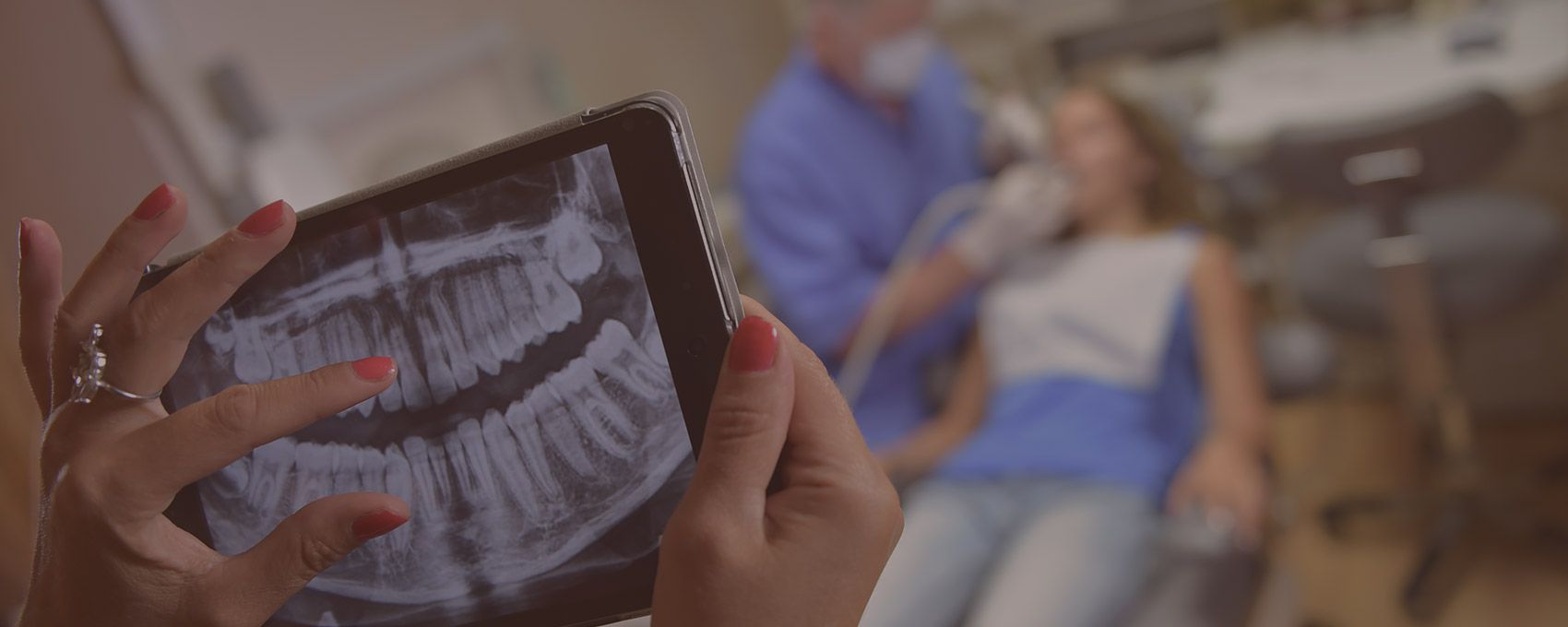 Digital Impressions - Westlake Family Dentistry