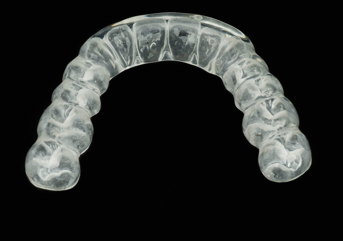 How to Clean Invisalign in Lake Oswego Area